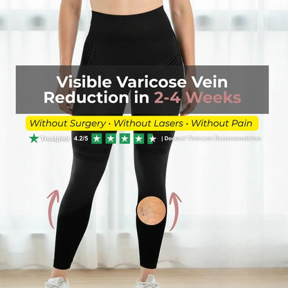 Visible Vein Relief in Just 14 Days with 3D Compression Leggings