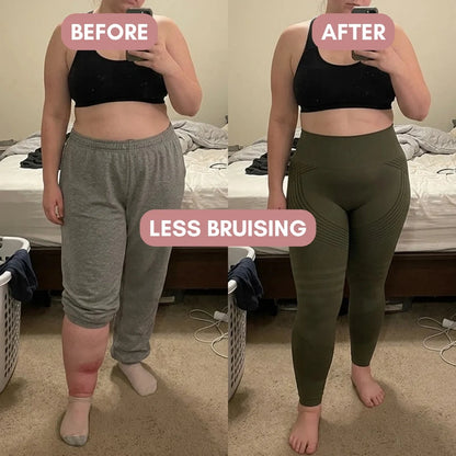 3D Legging – For Legs That Felt Like Anvils