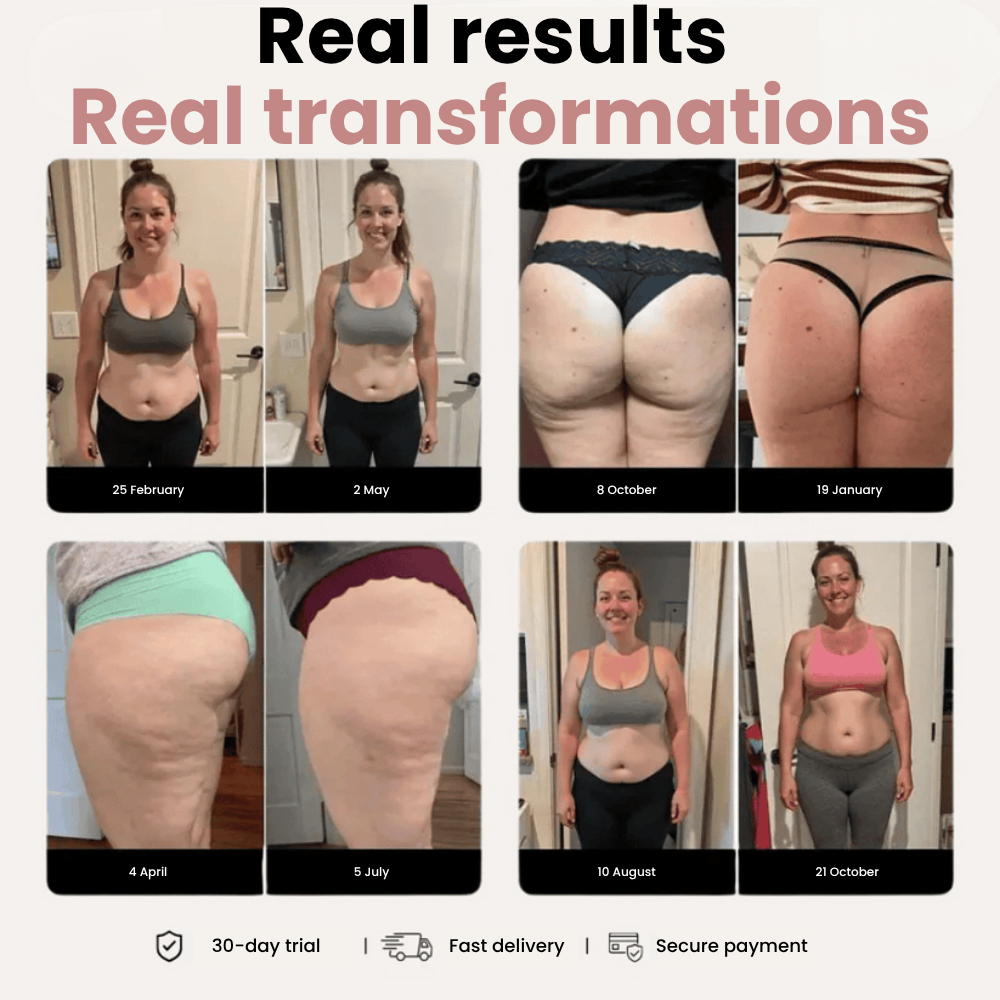 3D Legging – Say goodbye to lipoedema pain and swelling naturally.
